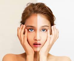 Ultra dealbatio: Synlotic Biotech scriptor Scientific Accede ad splendidior, Etiam-Toned Skin